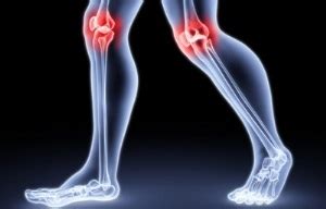 остеоартрит на лечението с озонова терапия на коляното